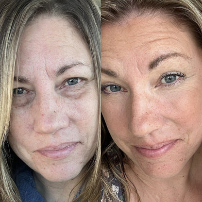RevitalEyes™ 2-in-1 Red Light + EMS Eye Bag Therapy